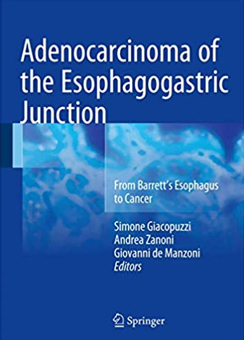 Adenocarcinoma of the Esophagogastric Junction Simone Giacopuzzi, ISBN-13: 978-3319287744