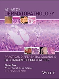 Atlas of Dermatopathology: Practical Differential Diagnosis by Clinicopathologic Pattern – eBook