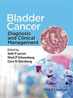 Bladder Cancer: Diagnosis and Clinical Management – eBook