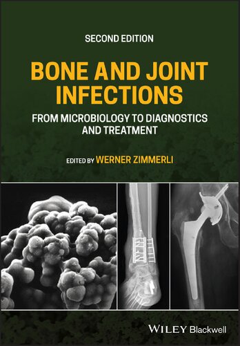 Bone and Joint Infections: From Microbiology to Diagnostics and Treatment (2nd Edition) – eBook