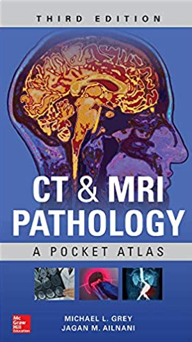 CT & MRI Pathology: A Pocket Atlas 3rd Edition by Michael Grey, ISBN-13: 978-1260121940