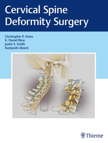 Cervical Spine Deformity Surgery – eBook