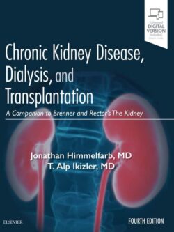 Chronic Kidney Disease, Dialysis, and Transplantation (4th Edition) – eBook