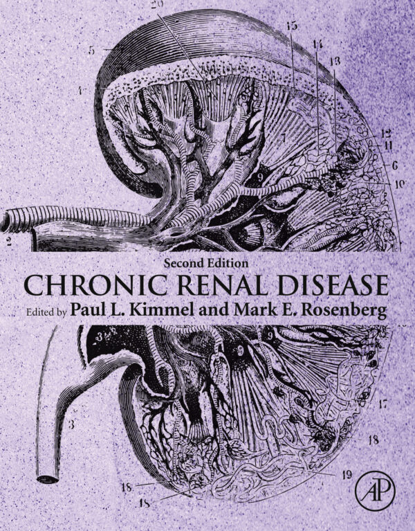 Chronic Renal Disease (2nd Edition) – eBook