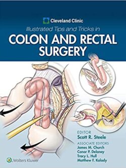 Cleveland Clinic Illustrated Tips and Tricks in Colon and Rectal Surgery – eBook