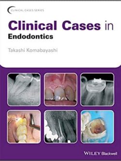 Clinical Cases in Endodontics – eBook