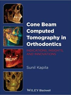 Cone Beam Computed Tomography in Orthodontics – eBook