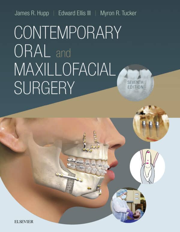 Contemporary Oral and Maxillofacial Surgery (7th Edition) – eBook