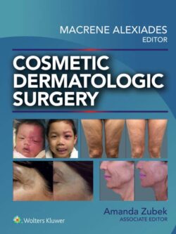 Cosmetic Dermatologic Surgery – eBook ZIP