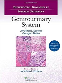 Differential Diagnoses in Surgical Pathology: Genitourinary System – eBook