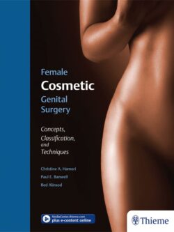 Female Cosmetic Genital Surgery: Concepts, Classification, and Techniques – eBook