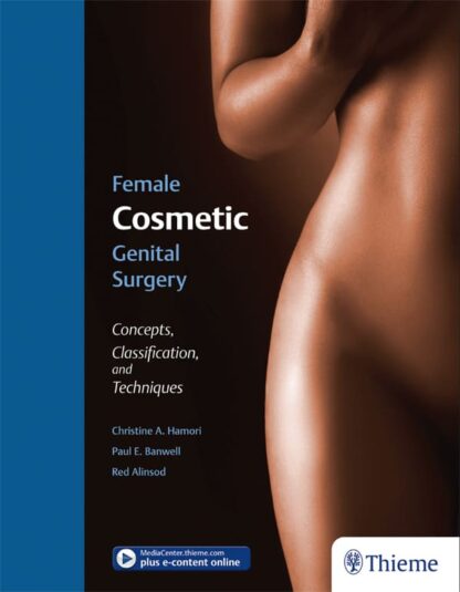 Female Cosmetic Genital Surgery: Concepts, Classification, and Techniques – eBook