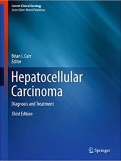 Hepatocellular Carcinoma: Diagnosis and Treatment (3rd Edition) – eBook