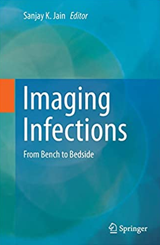 Imaging Infections: From Bench to Bedside 1st Edition Sanjay K. Jain, ISBN-13: 978-3319854335