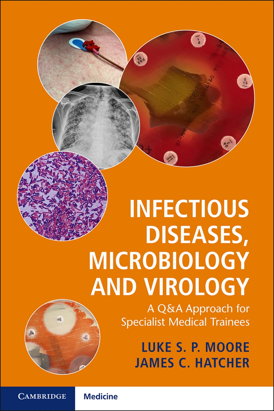 Infectious Diseases, Microbiology and Virology – eBook