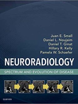 Neuroradiology: Spectrum and Evolution of Disease – eBook