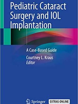 Pediatric Cataract Surgery and IOL Implantation: A Case-Based Guide – eBook