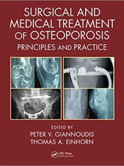 Surgical and Medical Treatment of Osteoporosis: Principles and Practice – eBook