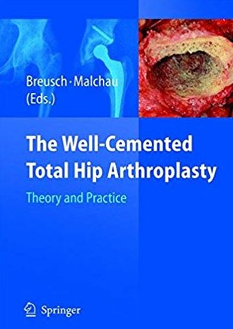 The Well-Cemented Total Hip Arthroplasty: Theory and Practice, ISBN-13: 978-3540241973