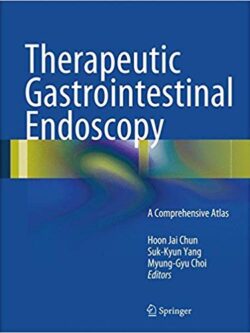 Therapeutic Gastrointestinal Endoscopy 1st Edition – eBook