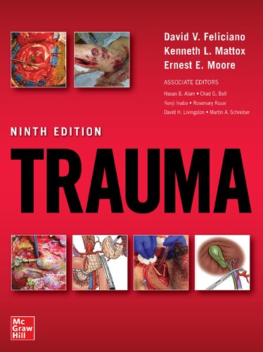 Trauma (9th Edition) – eBook