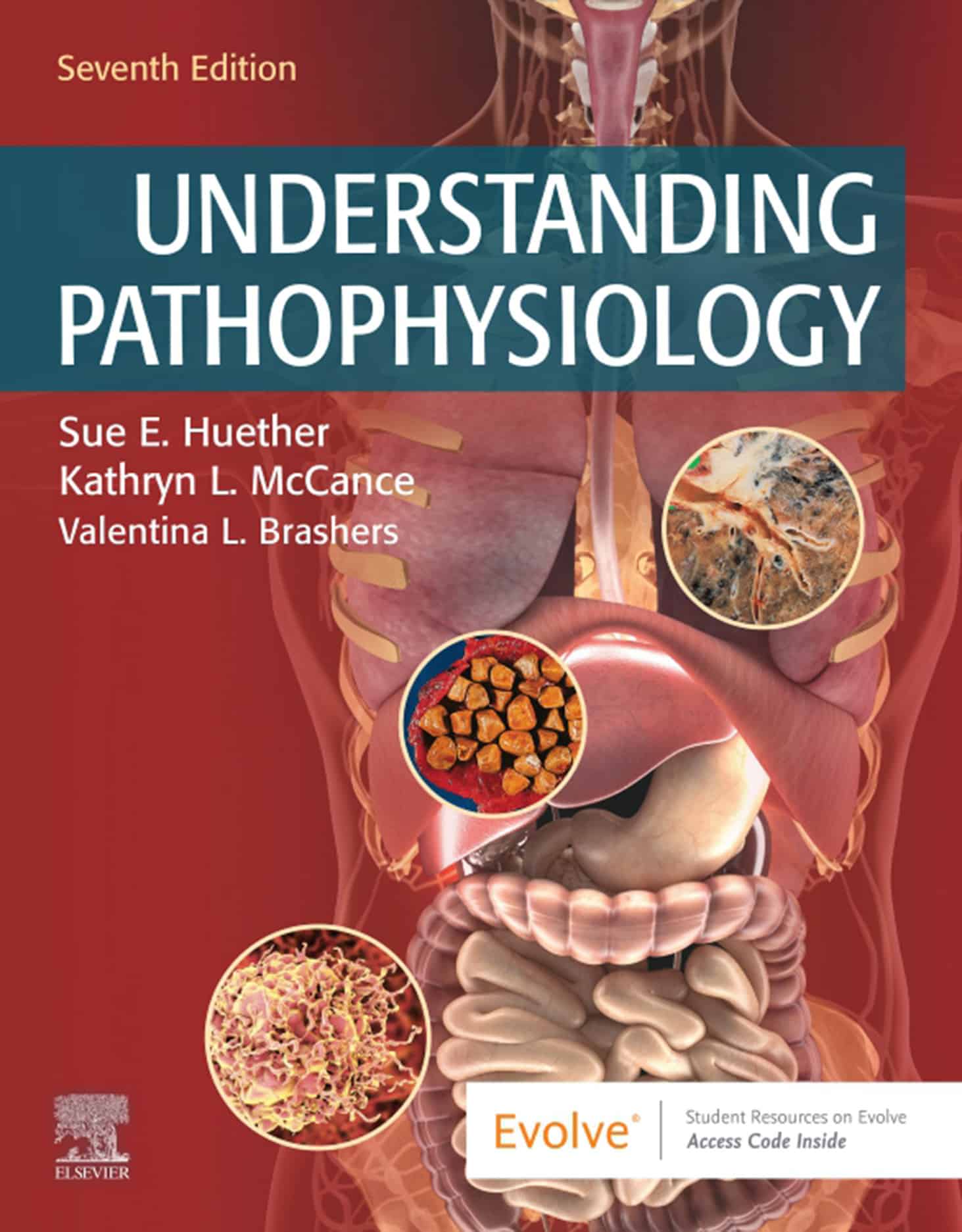 Understanding Pathophysiology (7th Edition) – eBook