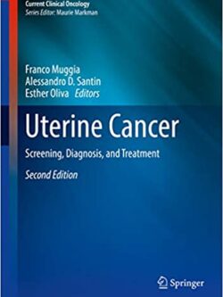 Uterine Cancer: Screening, Diagnosis, and Treatment (2nd Edition) – eBook